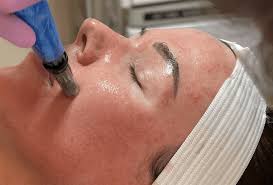 Microcurrent vs. Microneedling: A Guide to Skin Rejuvenation Treatments -  Microcurrent Healing