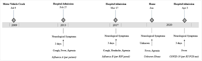 Covid 19 May Trigger Recurrent Guillain Barre Syndrome Episodes A Case Study Shows