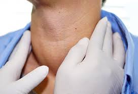 Image result for Goiter