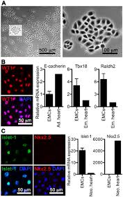In which the surface epithelium was flat (mesothelial type), the reaction for pax8 was negative while, in 12 cases, this type of epithelium was positive for calretinin (0 % vs 85 %). Plos One Mir 21 Promotes Fibrogenic Epithelial To Mesenchymal Transition Of Epicardial Mesothelial Cells Involving Programmed Cell Death 4 And Sprouty 1