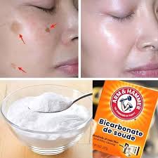BAKING SODA REMOVES AGE SPOTS, ACNE, BLACKHEADS! This is what you need to  do... 🔴 We are removing inactive members from here. If you want to keep  getting our recipes say something.😀