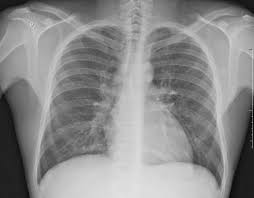 Pin On Radiology For Clinicians