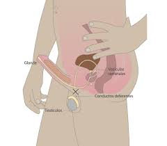 Vasectomia Argentina Gob Ar