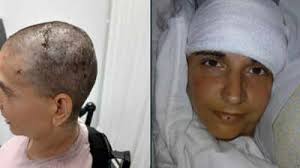 Who is Audrey Crews? Paralysed woman writes her name after 20 years using  Elon Musk's Neuralink brain chip