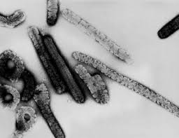 Marburg virus, first discovered in 1967, attracted widespread press attention in april 2005 for an outbreak in angola. Deadly Viral Disease Similar To Ebola Breaks Out In Uganda