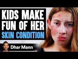 Kids MAKE FUN Of Girl's SKIN CONDITION, What Happens Is Shocking