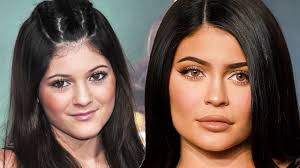 Kylie jenner surgery claims sweep the internet on a regular basis, usually after the star posts yet another sultry instagram picture. Kylie Jenner Transformation Over The Years Youtube