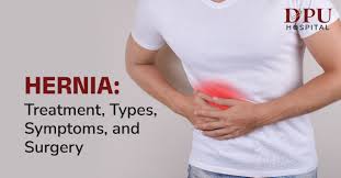 Image result for stomach hernia symptoms