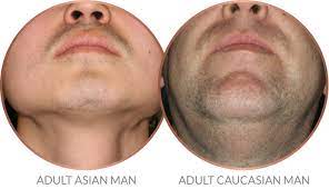 Treatment of abnormal facial hair. Beard Growth Science Stages Of Beard Growth Gillette