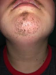 You can also darken your facial hair with the help of a natural home remedy, for example, black walnuts. This Is The Most Euphoria I Ve Ever Felt This Is My Natural Facial Hair 5 Months On Testosterone Darkened With A Bit Of Mascara No Minoxidil Ftm