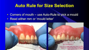 selecting denture teeth revised