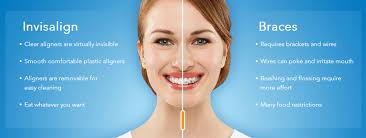 invisalign san diego ca brighton dental