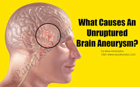 Blood collects in this weak spot however, as the vessel continues to increase in size, you could experience symptoms caused by the. What Causes An Unruptured Brain Aneurysm