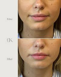 Anna Forsman (@eklandakliniken) • Instagram photos and videos