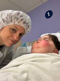 Has anyone experienced optic nerve swelling and shunt surgery for  idiopathic intracranial hypertension?