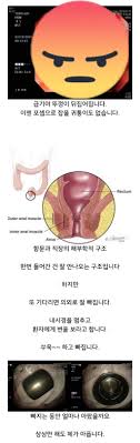 항문에 자꾸 뭘 넣는 남자들 때문에 고통받는 응급실 의사분들ㅋㅋㅋㅋ - 악플달면 쩌리쩌려버려 - ＊여성시대＊ 차분한 20대들의 알흠다운  공간