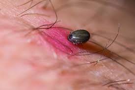 Image result for infected tick bite