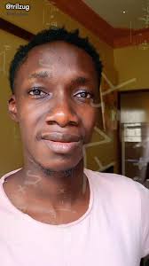 Concerning Observation: Smelly Feet and a Running Nose