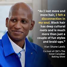 Wrote something about having alopecia. Link in bio Alan Shane Lewis,  co-host of CBC's The Great Canadian Baking Show was 17 when he discovered  he had alopecia, and losing his Black hair