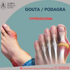 Alpha Medical Clinic | Gouta / Podagra 📌 Hiperuricemia është një sëmundje  metabolike e cila karakterizohet nga rritja e vlerave te acidit urik në  gjak.... | Instagram