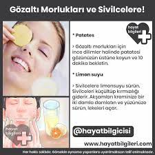 Anasayfa Hayat Bilgi Cilt Beyazlatma