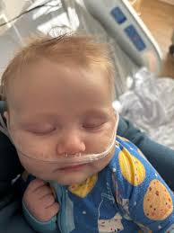 UPDATE ON BABY SAYLOR: He is still in the hospital. He was doing better but  in the night that had to put oxygen back