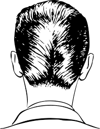 Free Image On Pixabay Man Head Back Of Head Ducktail Ducktail Haircut Hair Loss Symptoms