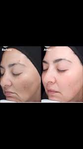 Undo summer damage with our VI...