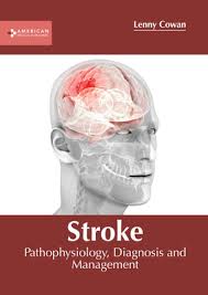 Image result for Stroke Pathophysiology