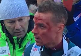 Born 16 january 1987) is a polish ski jumper. Piotr Zyla Zakrwawiony Kibice Zamilkli Po Upadku Skoczka Wideo