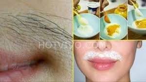 Sut Ile Ust Dudak Tuylerinden Kurtulacaksiniz Remove Unwanted Facial Hair Unwanted Facial Hair Facial Hair Removal