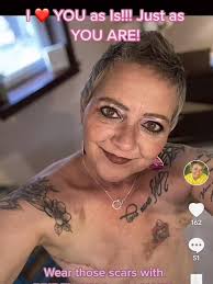 Don't cast the first insult at someone with bad hair. You might get the  hairline fracture