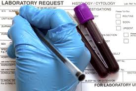 An amh (antimullerian hormone) test can be useful for women with pcos, particularly in those who are struggling with receiving a diagnosis. Polycystic Ovary Syndrome Support Groups Are Helpful Pcos Awareness Association