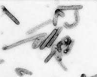 Confirmation of marburg virus requires laboratory testing (image: Marburg Marburgvirus Wikiwand