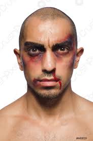 Hombre Muy Golpeado Aislado Sobre Blanco Foto De Stock Crushpixel