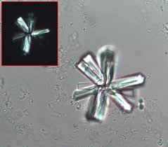 A Star Like Calcium Phosphate Crystal Birefringent Under Polarized Light Bright Fi Medical Laboratory Scientist Medical Laboratory Medical Laboratory Science