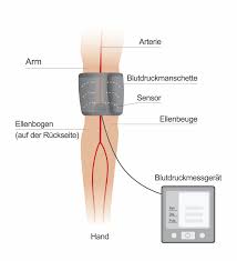 Messen sie zum ersten mal, sollten sie den blutdruck an beiden armen überprüfen und später immer an dem arm, der den höheren wert angezeigt hat. Blutdruckmessung Oszillometrisch Oder Nach Korotkow Infothek Blutdruckdaten