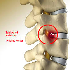 We did not find results for: Pinched Nerve Treatment Monmouth Pain And Rehabilitation