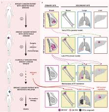 The signs and symptoms of recurrence depend on where breast cancer returns. The Lingering Mysteries Of Metastatic Recurrence In Breast Cancer British Journal Of Cancer