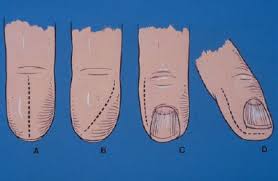 Image result for Felon