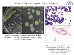 Furthermore, they possess properties infrequently observed in other bacteria, such as the ability to. Gram Staining Ppt Download