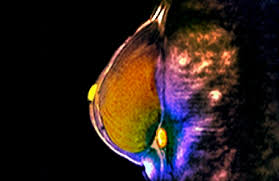 Patriotism 9/11 heroes support of our troops fireworks safety. Investigating Causal Relations Between Sleep Traits And Risk Of Breast Cancer In Women Mendelian Randomisation Study The Bmj