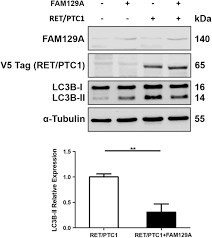 For fan entertainment purposes only.só vejo a hora de você chegar.a volta, de roberto e erasmo carlos, é a faixa 2 do. Fam129a Regulates Autophagy In Thyroid Carcinomas In An Oncogene Dependent Manner In Endocrine Related Cancer Volume 26 Issue 1 2019
