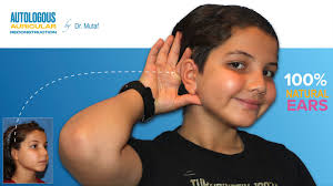 Meet our amazing patient, Defne! Born with unilateral, Grade III microtia,  she now celebrates life with her new ear and sparkling earrings that light  up her smile. We know dear Defne has