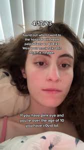 For those of you who think c0vid is over. This is by far worse then an...