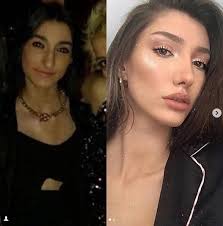 Bit.ly/2ssb3fl magazin dünyasının yakından takip ettiği hande erçel'in, eski fotoğrafları ortaya çıktıktan sonra. Turkiye Guzelinin Estetiksiz Hali Saskina Cevirdi Sinirsiz Hit Muzik