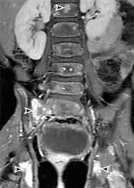 Once we cover the fundamentals of backbone, then we'll cover unit testing and modularising the code. Mr Imaging Of Pediatric Bone Marrow Radiographics