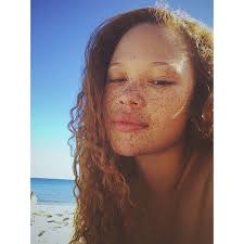 Image result for Freckled skin