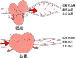 循環器疾患について「高血圧」｜大阪医科薬科大学 循環器内科