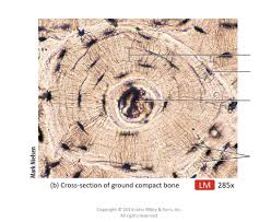 Important features in the bone cross section such as harvesian canals, osteons, osteon fragments, lamellar bone, bony trabeculae, myxoid matrix and artifact for. Fig 8 3 Gross Microscopic Features Of Compact And Spongy Bone Diagram Quizlet